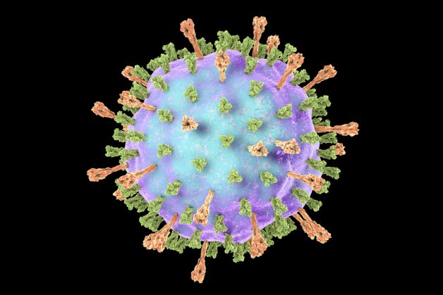 Virus Mumps, thuộc chi Rubulavirus, họ Paramyxoviridae gây ra quai bị